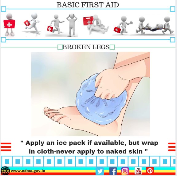 Apply an ice pack if available, but wrap in cloth-never apply to naked skin 